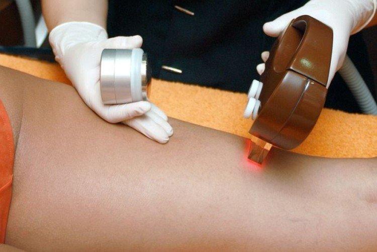 Рубиновый лазер