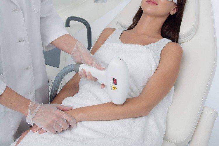 Диодный лазер