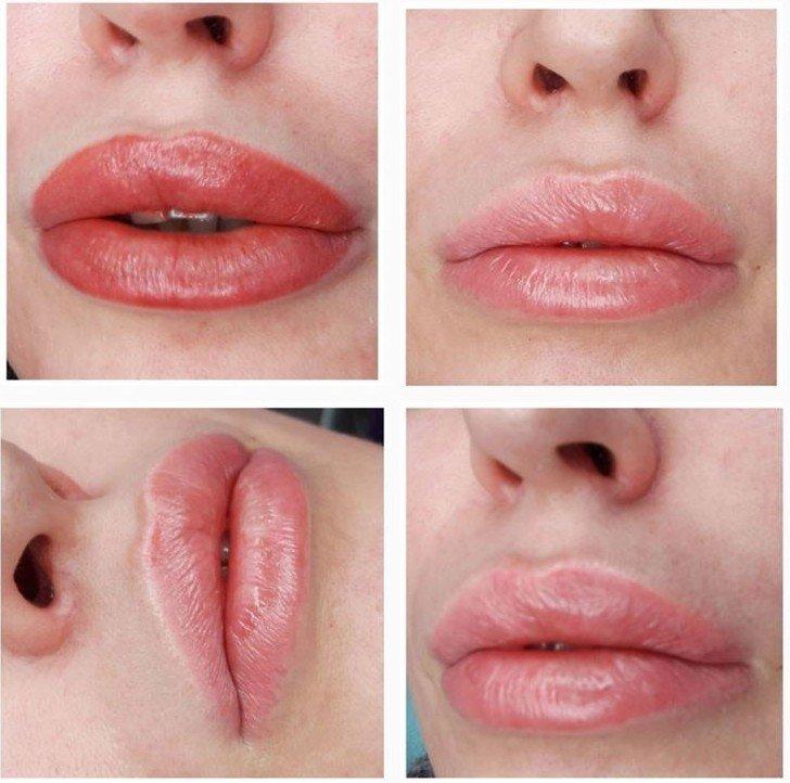 Перманентный макияж губ - фото до и после