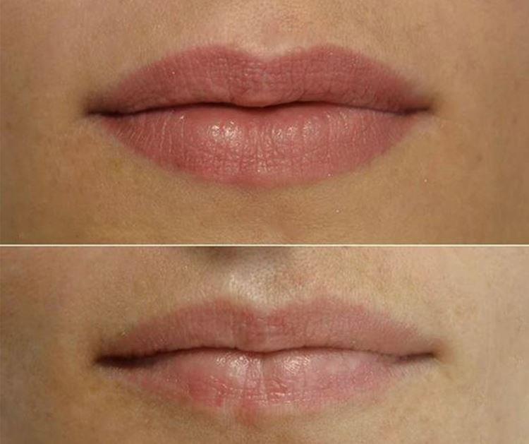 Перманентный макияж губ - фото до и после