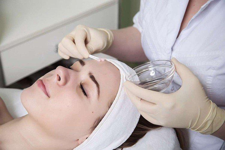 Поверхностный пилинг лица