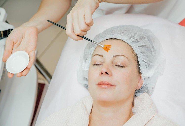 Глубокий пилинг лица