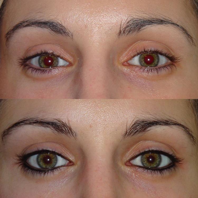 Татуаж глаз - фото до и после
