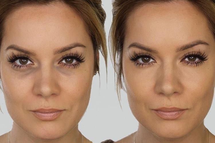 Темные круги под глазами - Ошибки вечернего макияжа